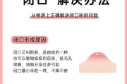 如何有效去除青春痘的方法？哪些家庭疗法最有效？