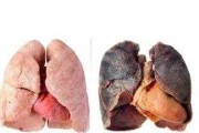 吸烟的危害有哪些方面？如何减少吸烟带来的健康风险？