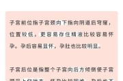 子宫后位如何提高受孕率？有效方法有哪些？