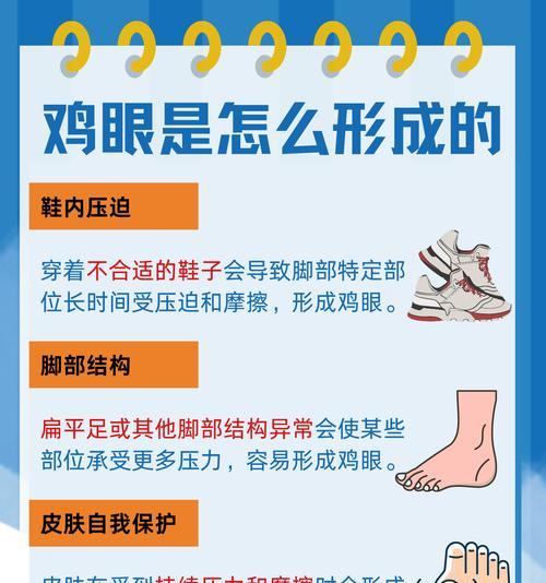 脚上鸡眼怎么治才能消失？有效治疗方法有哪些？