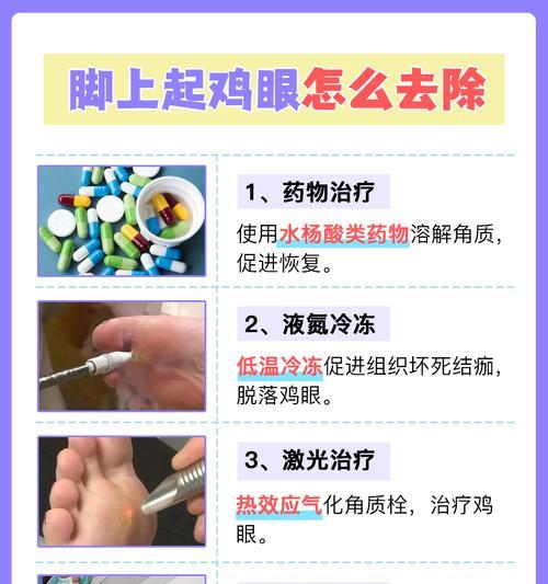 脚上鸡眼怎么治才能消失？有效治疗方法有哪些？