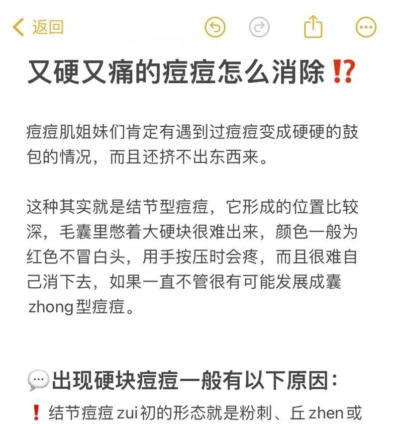 如何有效去除青春痘的方法？哪些家庭疗法最有效？