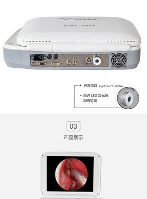 苹果手机内窥镜哪个品牌更可靠？如何选择？